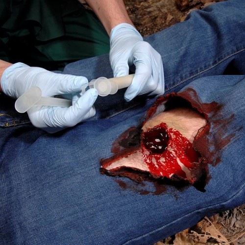 Аппликатор гемостатический с гранулами Rhino Rescue в Люберцах хитозановый